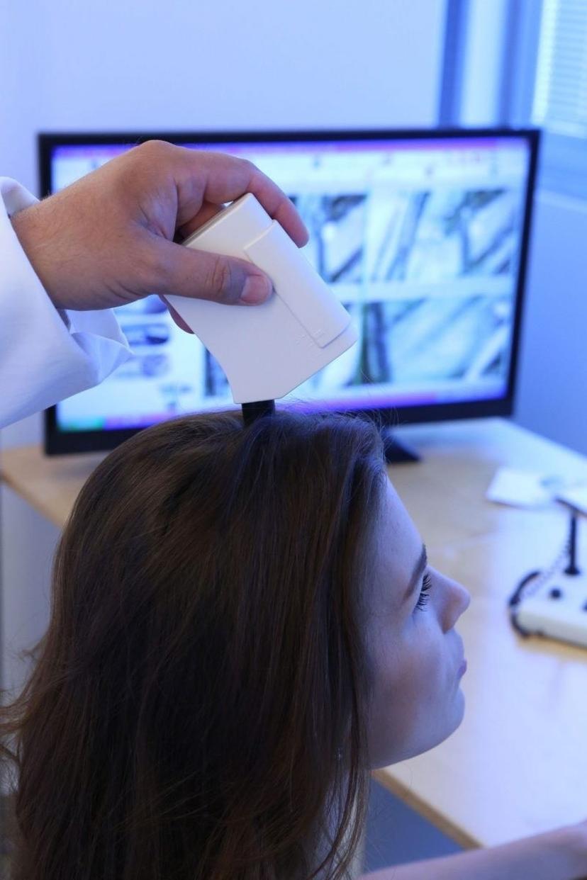 Galvos odos ir plauko būklės tyrimas „TricoTest“