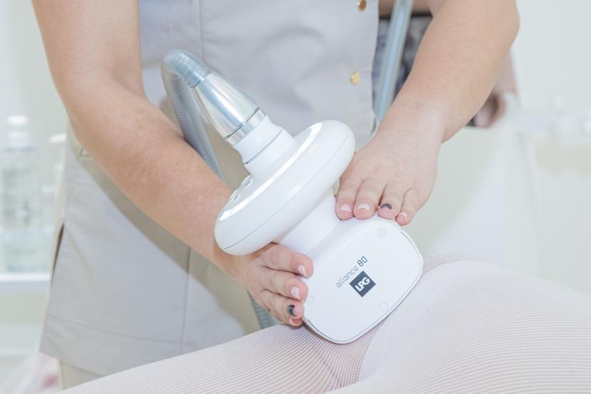 LPG endermologie kūno procedūra „Skysčių drenavimas“ 