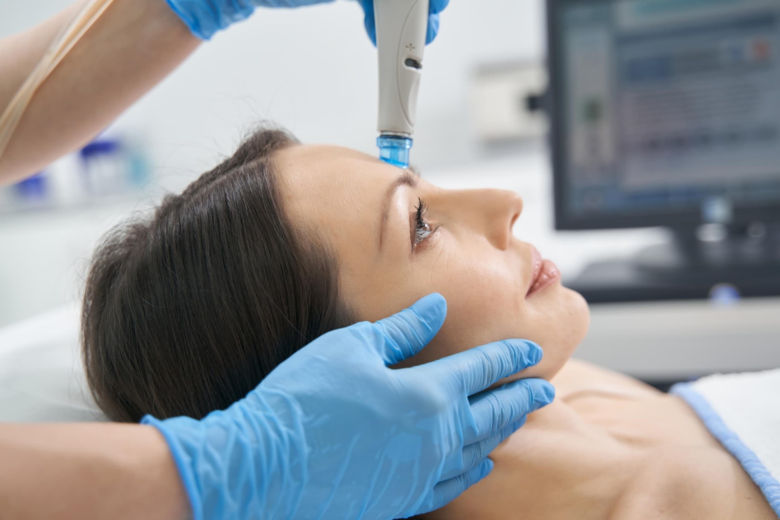 „HydraFacial“ - 4 etapų procedūra