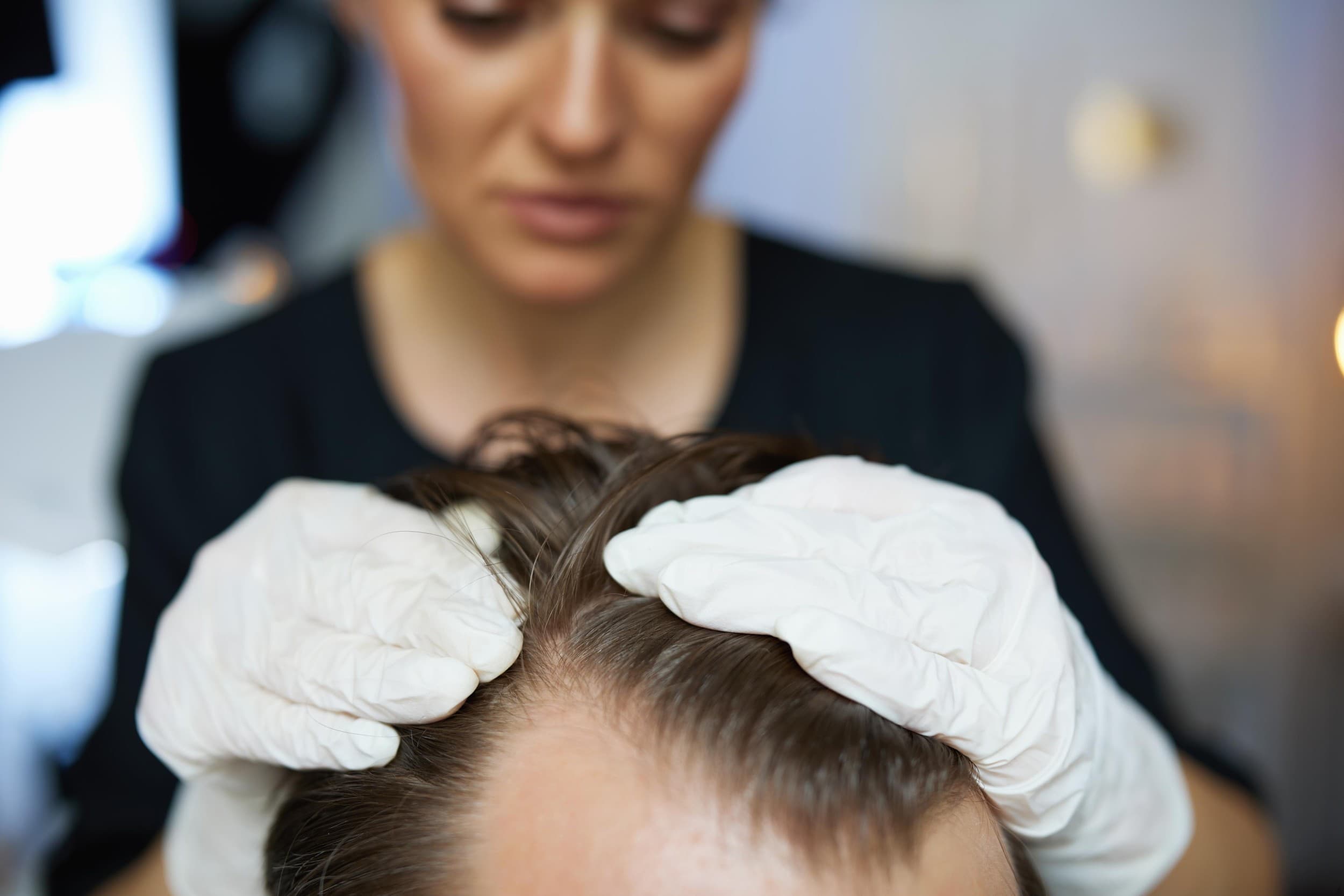 Progresyvi mezoterapija plaukams „HAIR REPAIRE“ | Laisvalaikio Dovanos