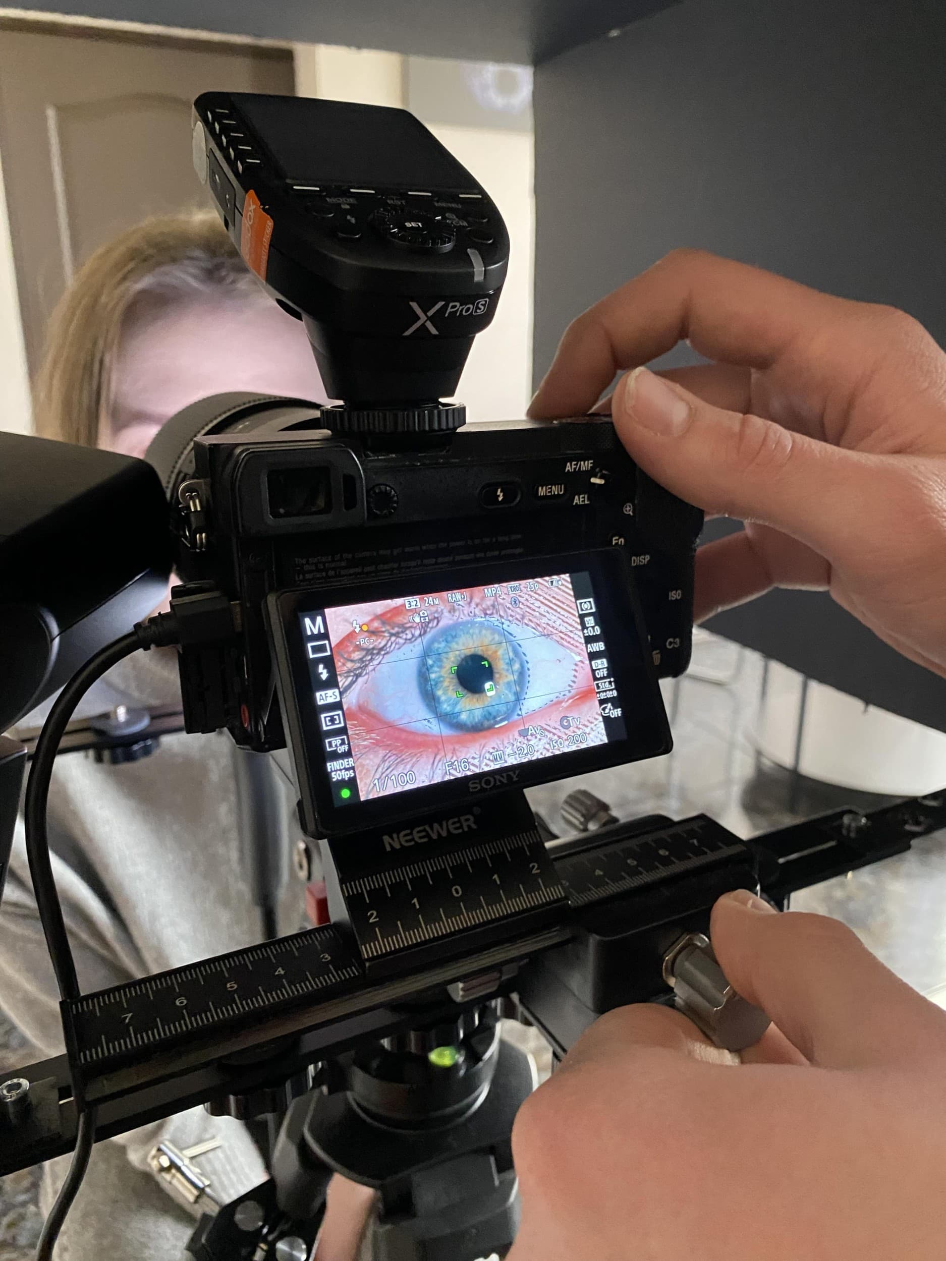Skaitmeninė 2 akių rainelių nuotrauka studijoje „EyeArt“