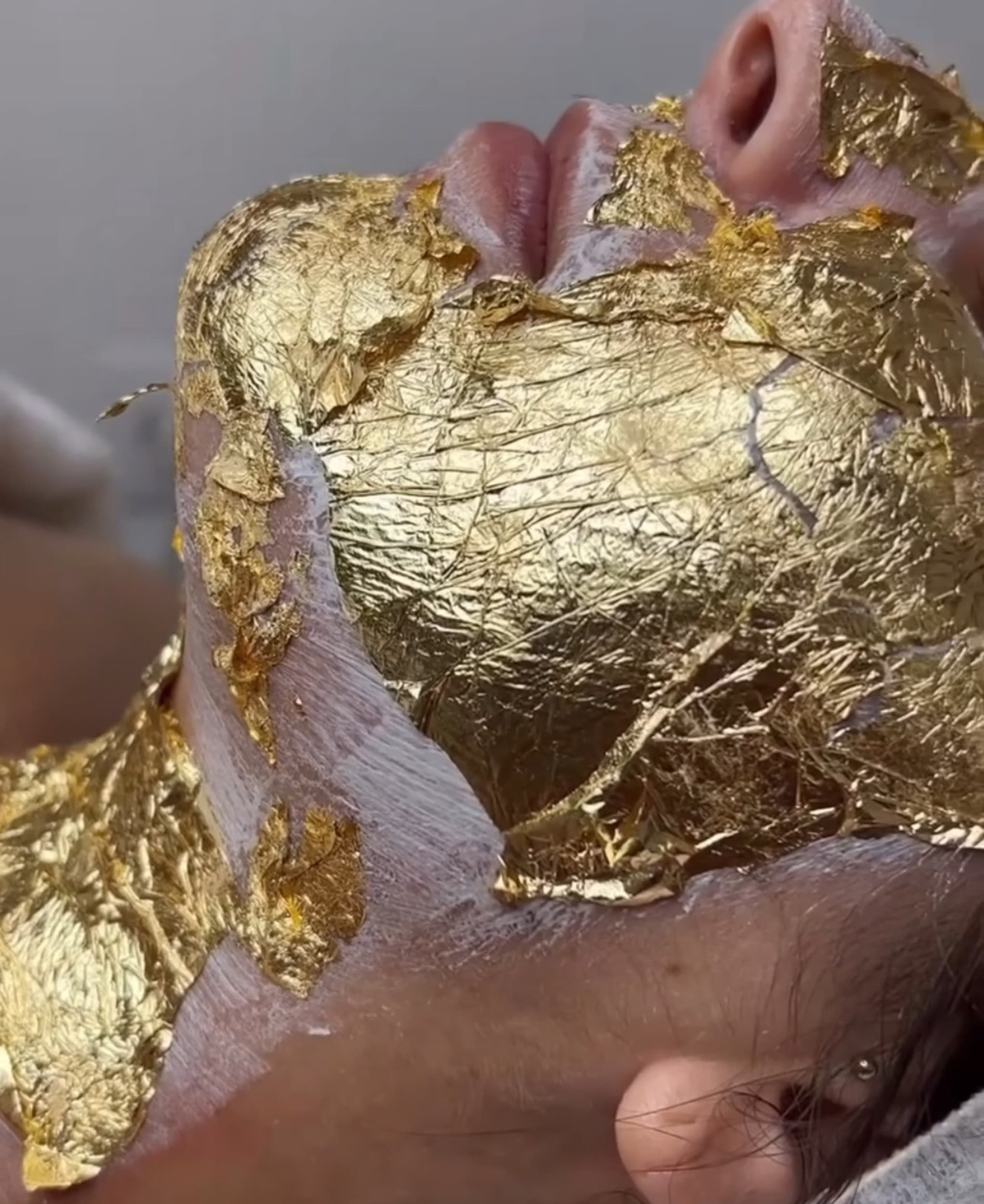 Beadatė mezoterapija „Aurum Gold“ | Laisvalaikio Dovanos