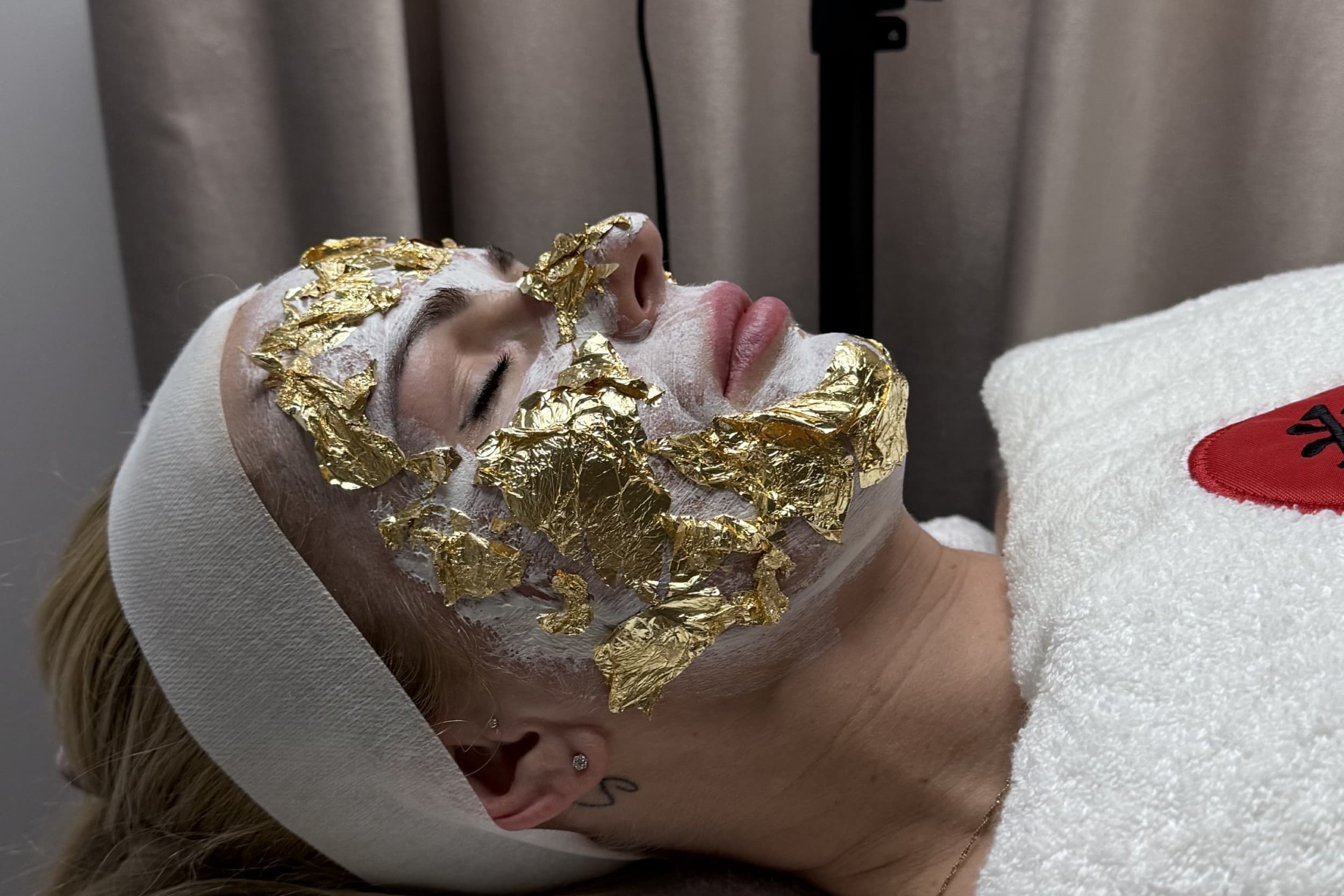 Beadatė mezoterapija „Aurum Gold“ + mezoterapija lūpoms „Hyalu-In“ | Laisvalaikio Dovanos