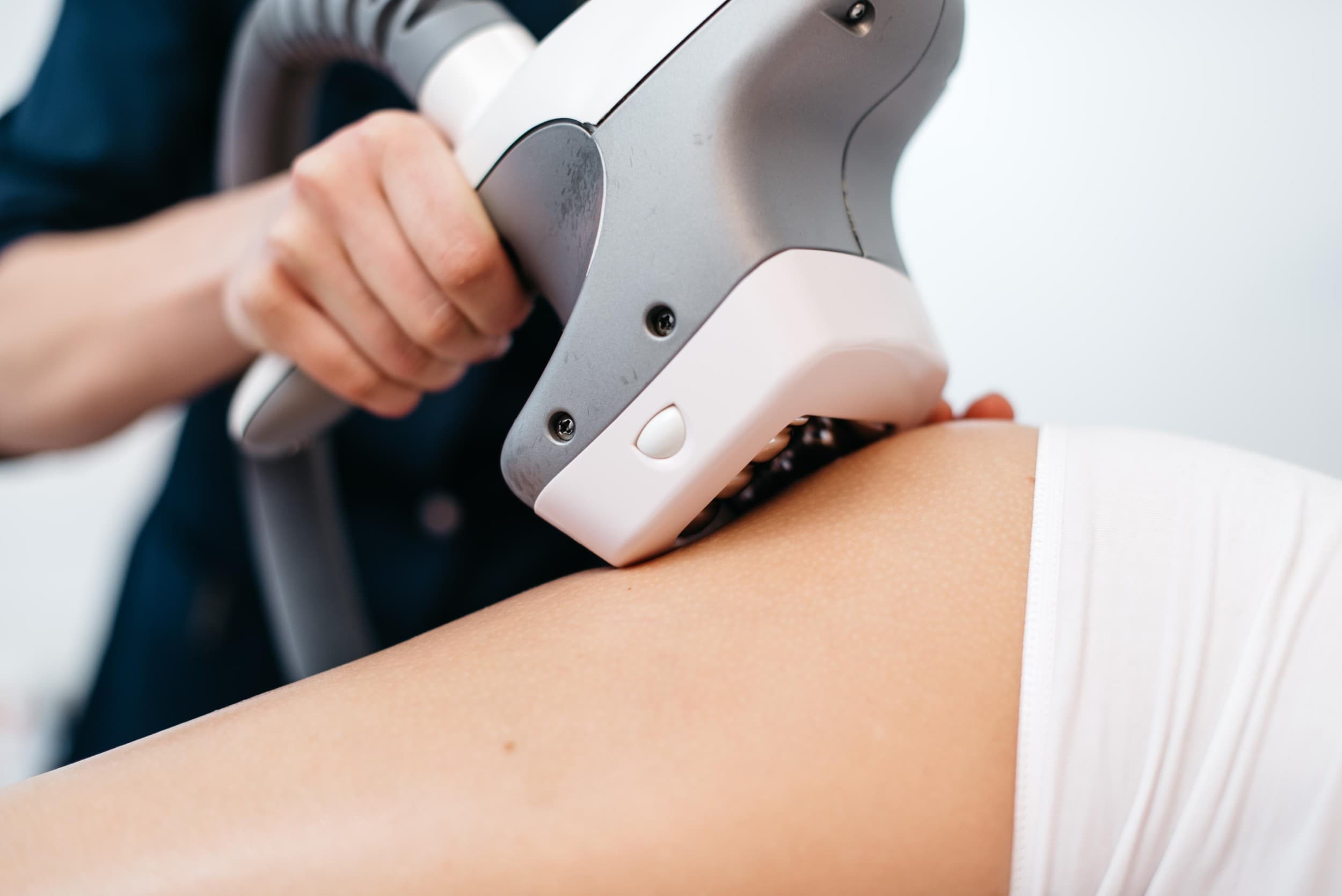 „VelaShape“ procedūra rankų zonai