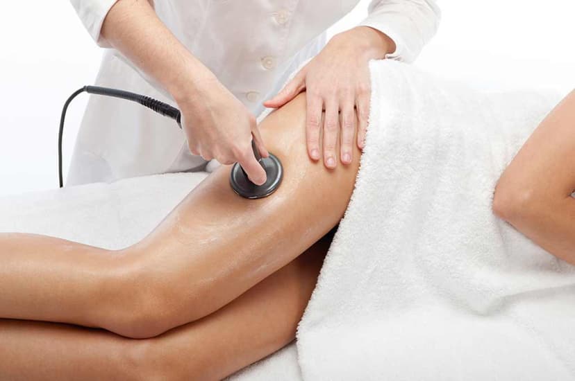 „Indiba activ“ terapija